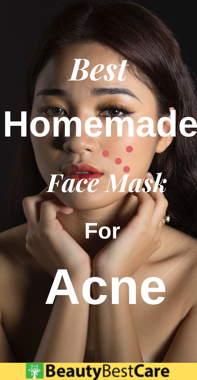 face mask for acne